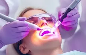 Laser Frenectomy and Gingivectomy
