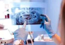Low-dose digital dental X-ray imaging