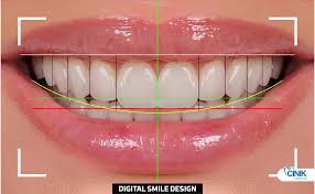 Digital Smile Designing
