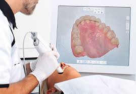 Intra Oral Scanner Facility